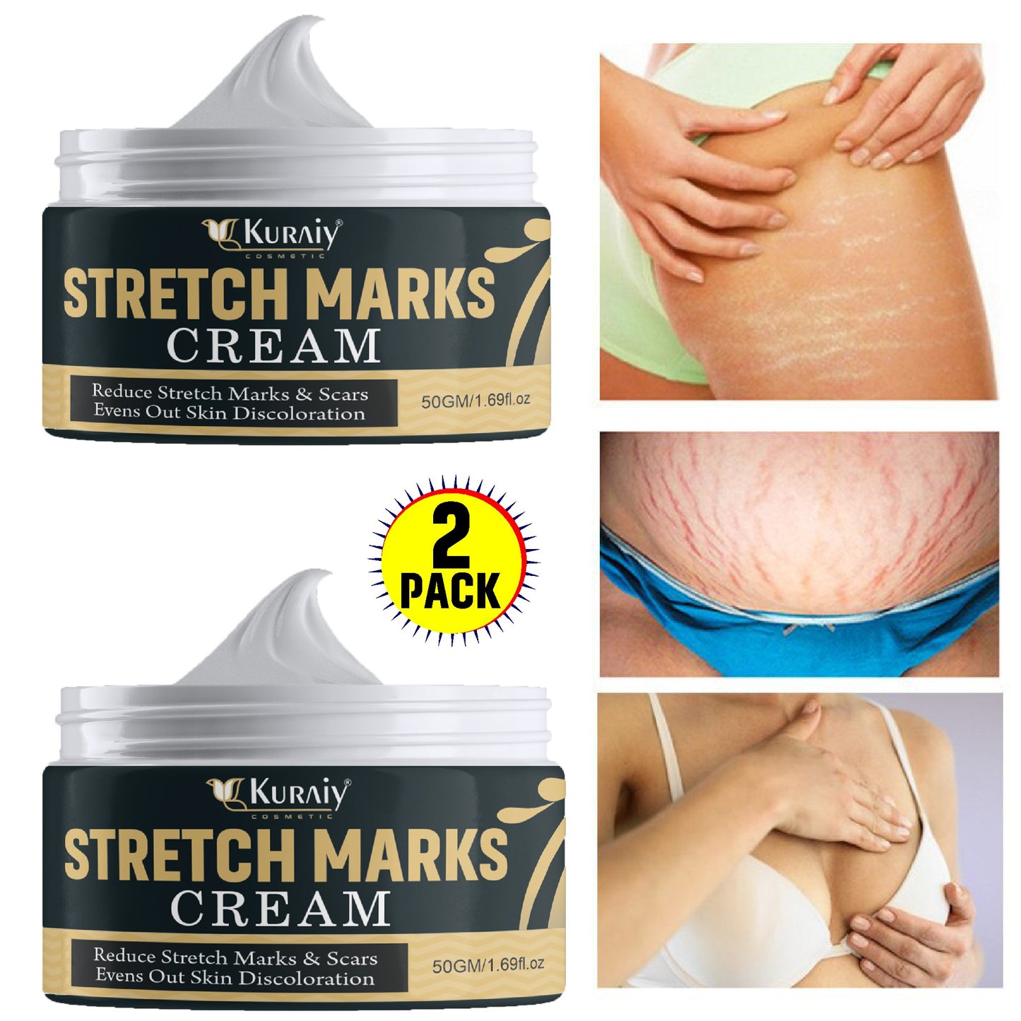 Natural Stretch Marks Removal Cream 50g (Buy 1 Get 1 FREE)