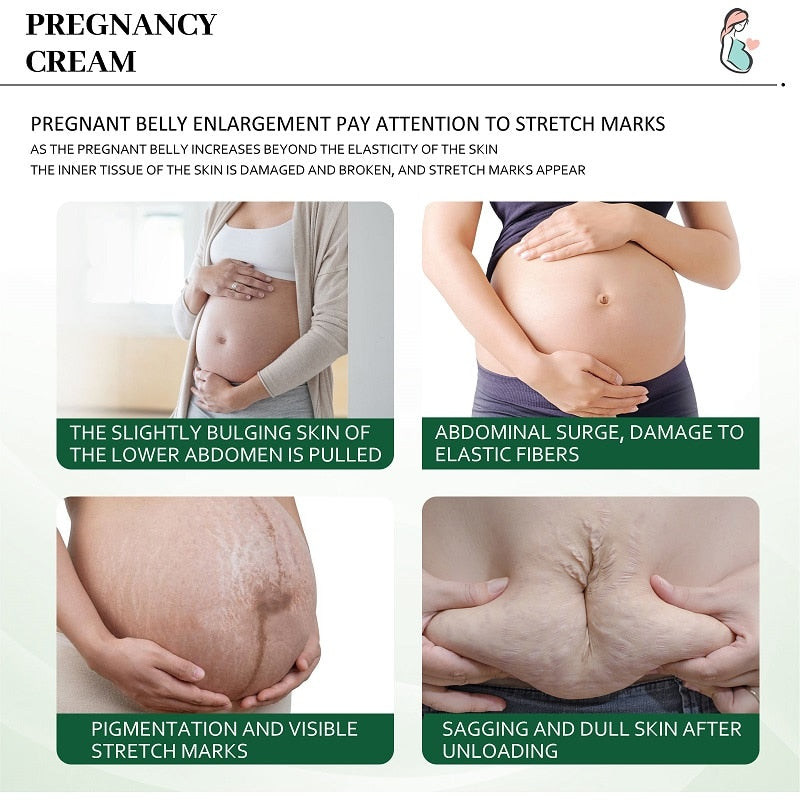 Natural Stretch Marks Removal Cream 50g (Buy 1 Get 1 FREE)