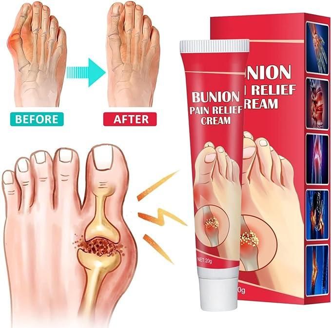 Bunion Pain Relief Cream (Buy 1 Get 1 Free)