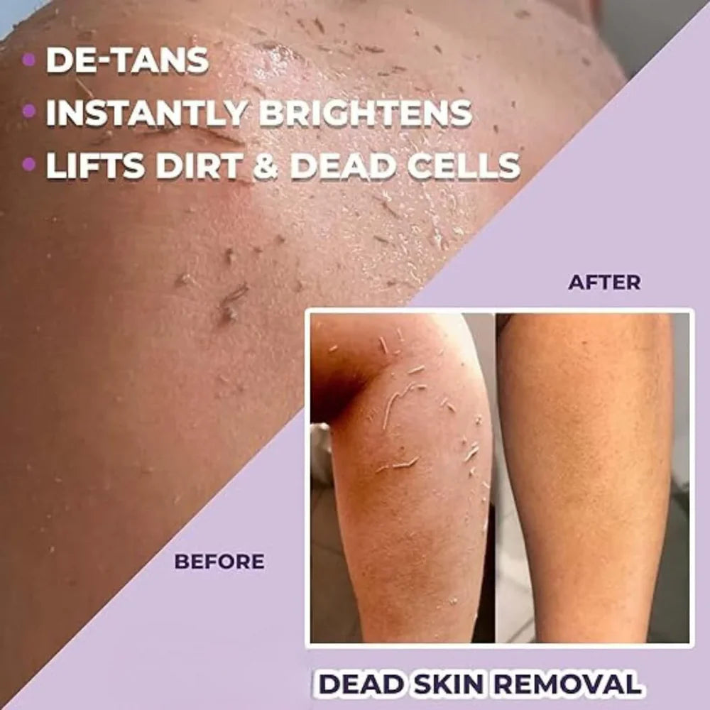 Dead Skin & Tan Remover for Smooth, Radiant Skin 🌞✨ (Buy 1 Get 1 Free)