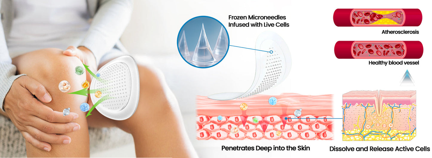 Hyaluronic Joint Relief Microneedle Patch 🔥🔥 (Pack of - 10/20)