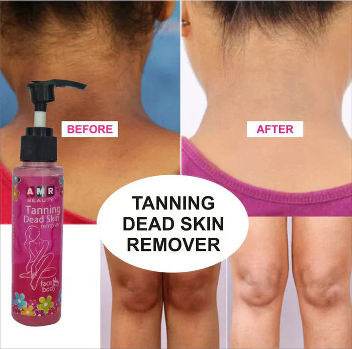 Dead Skin & Tan Remover for Smooth, Radiant Skin 🌞✨  (Buy 1 Get 1 Free)
