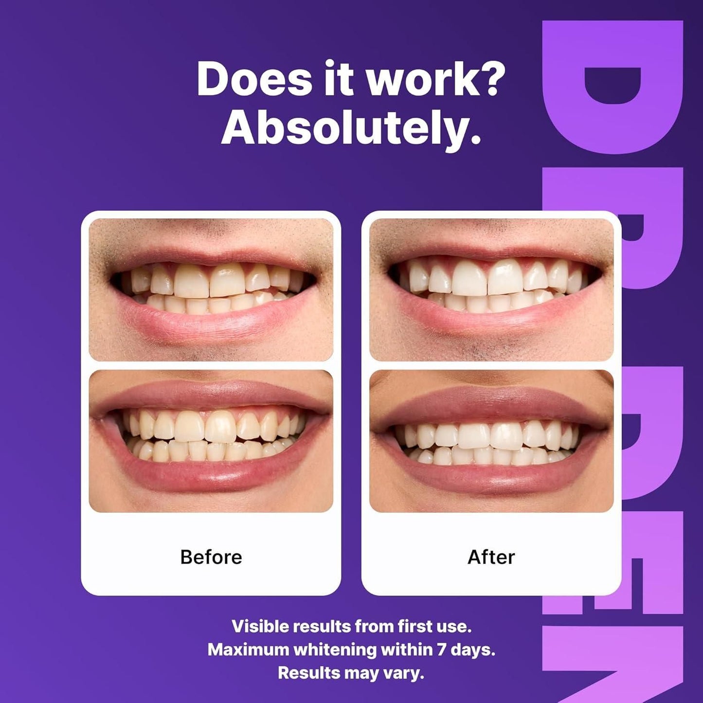 Purple™ Teeth Whitening Strips (42 strips)