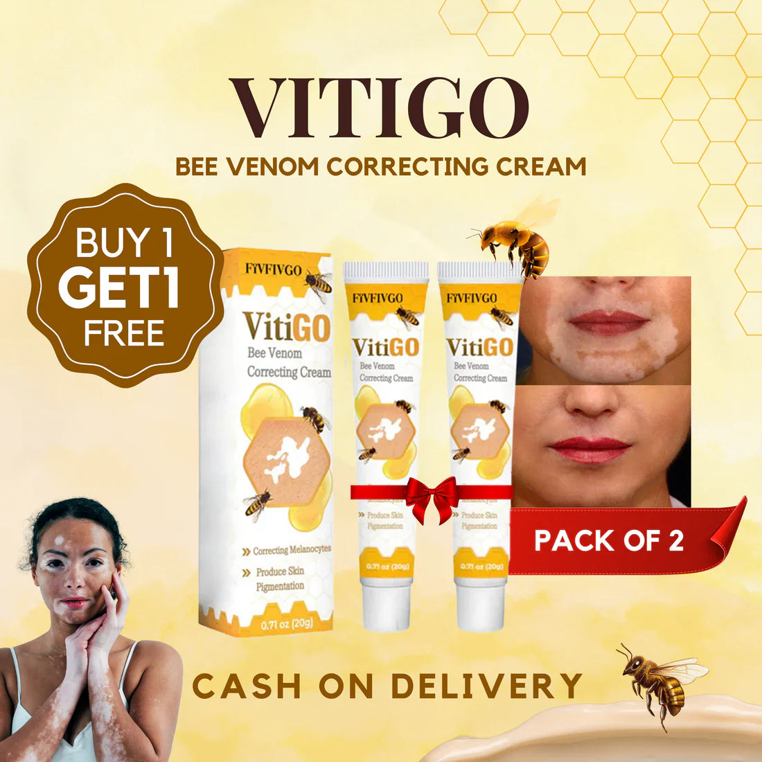 VitiGO Bee Venom Treatment Cream (Buy 1 Get 1 Free)
