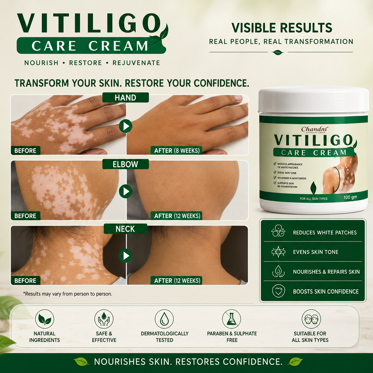 VITILIGO Care Cream (Buy 1 Get 1 FREE)