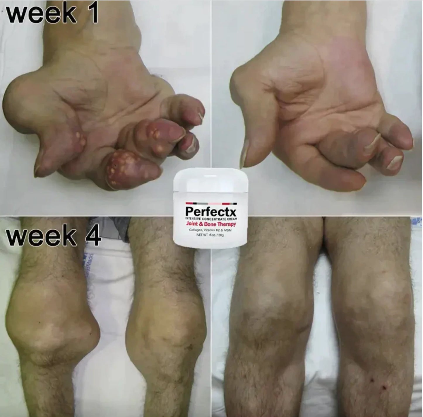 Perfectx Joint and Bone Treatment Cream (Buy 1 Get 1 Free)