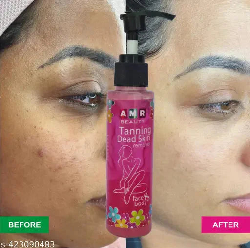Dead Skin & Tan Remover for Smooth, Radiant Skin 🌞✨  (Buy 1 Get 1 Free)