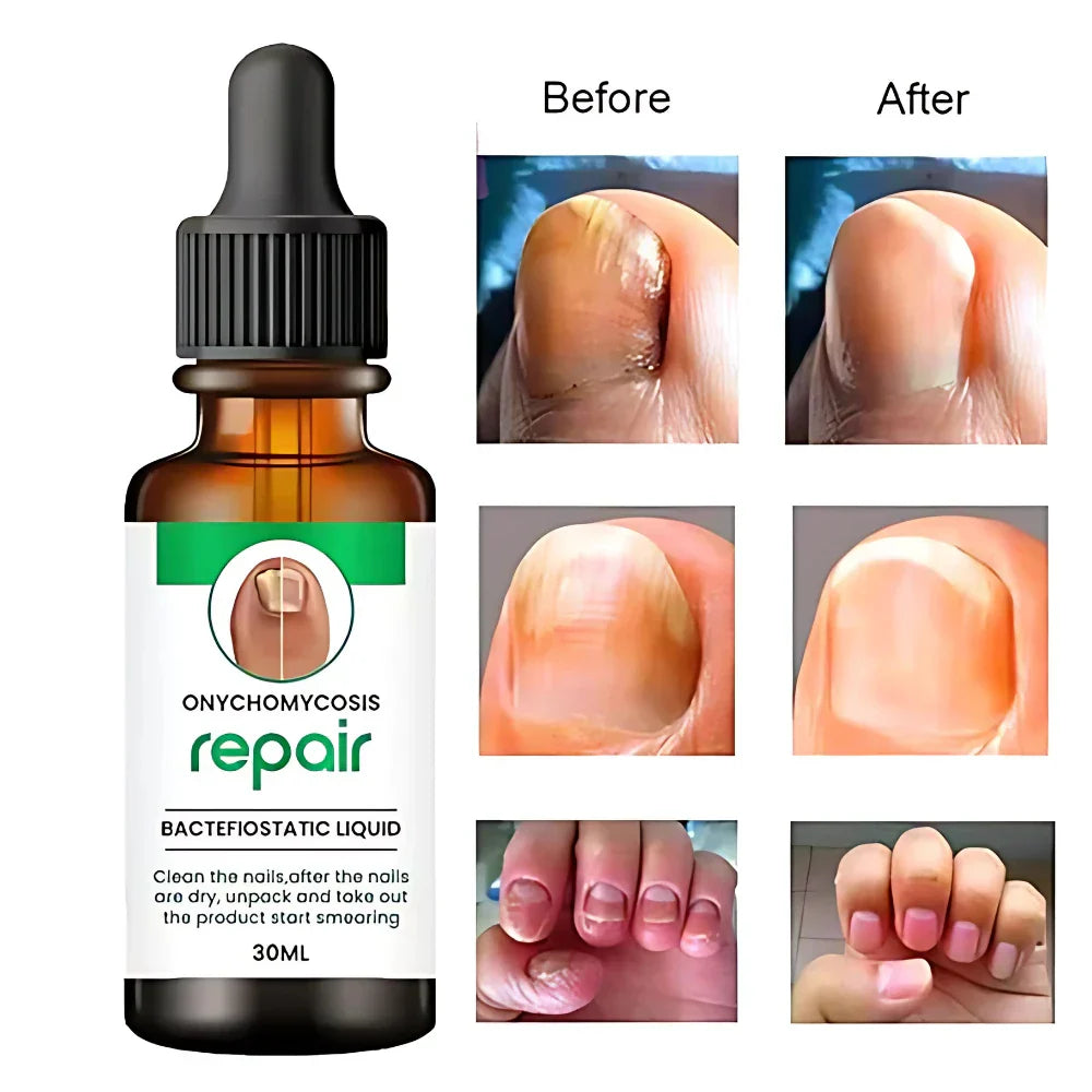 Nail Growth Repair Oil