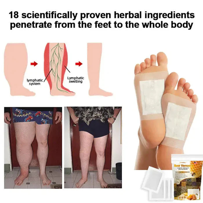 Bee Venom Lymphatic Drainage & Slimming Foot Patches 🌿 (Set of 10)